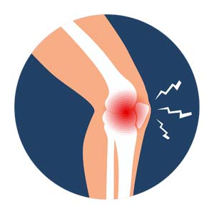 why-does-my-knee-hurt-03